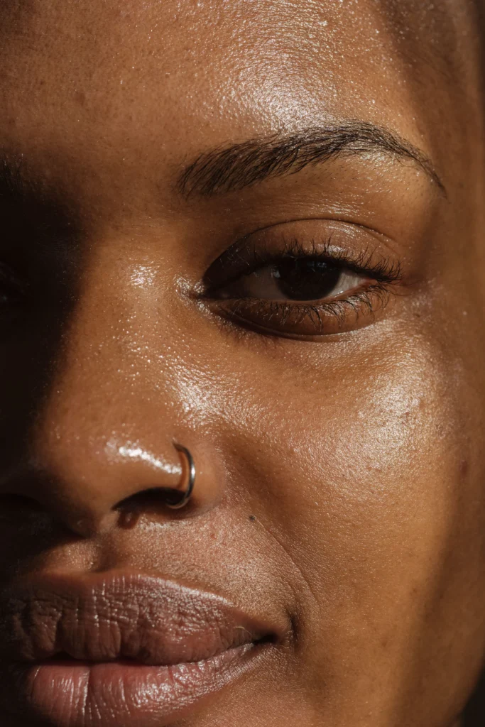 mulher negra com o rosto oleoso e com marcas de espinhas sem fazer uma rotina de skincare para pele oleosa
